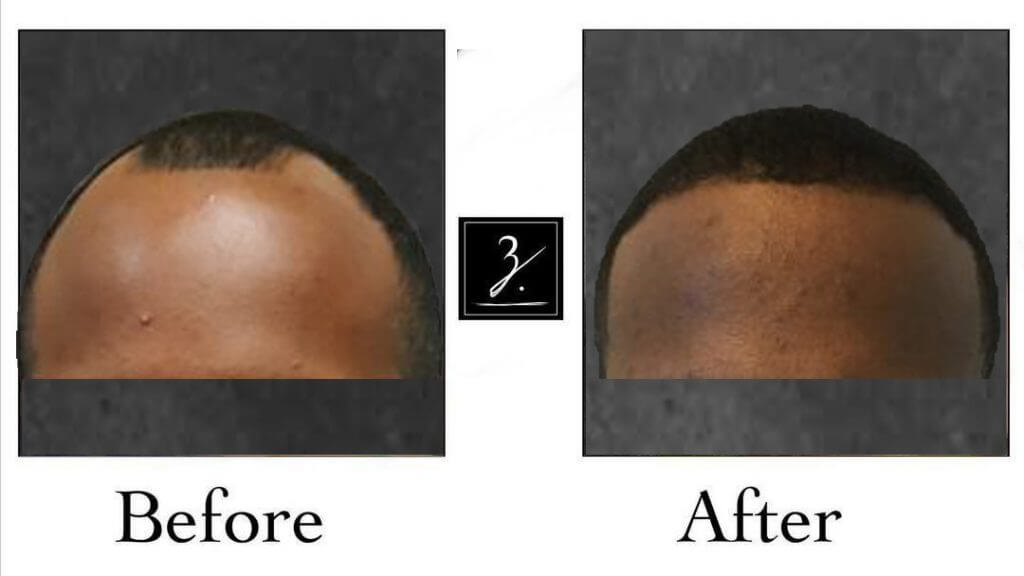 african american damaged hair before and after