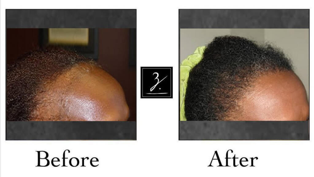 african american damaged hair before and after