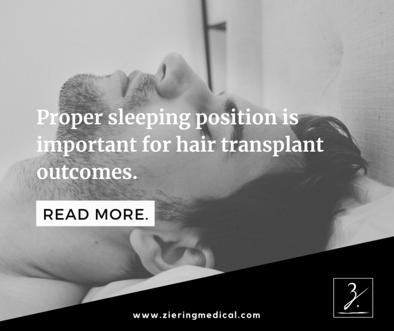 Getting Comfortable Sleep After FUE Hair Transplant — Ziering Medical
