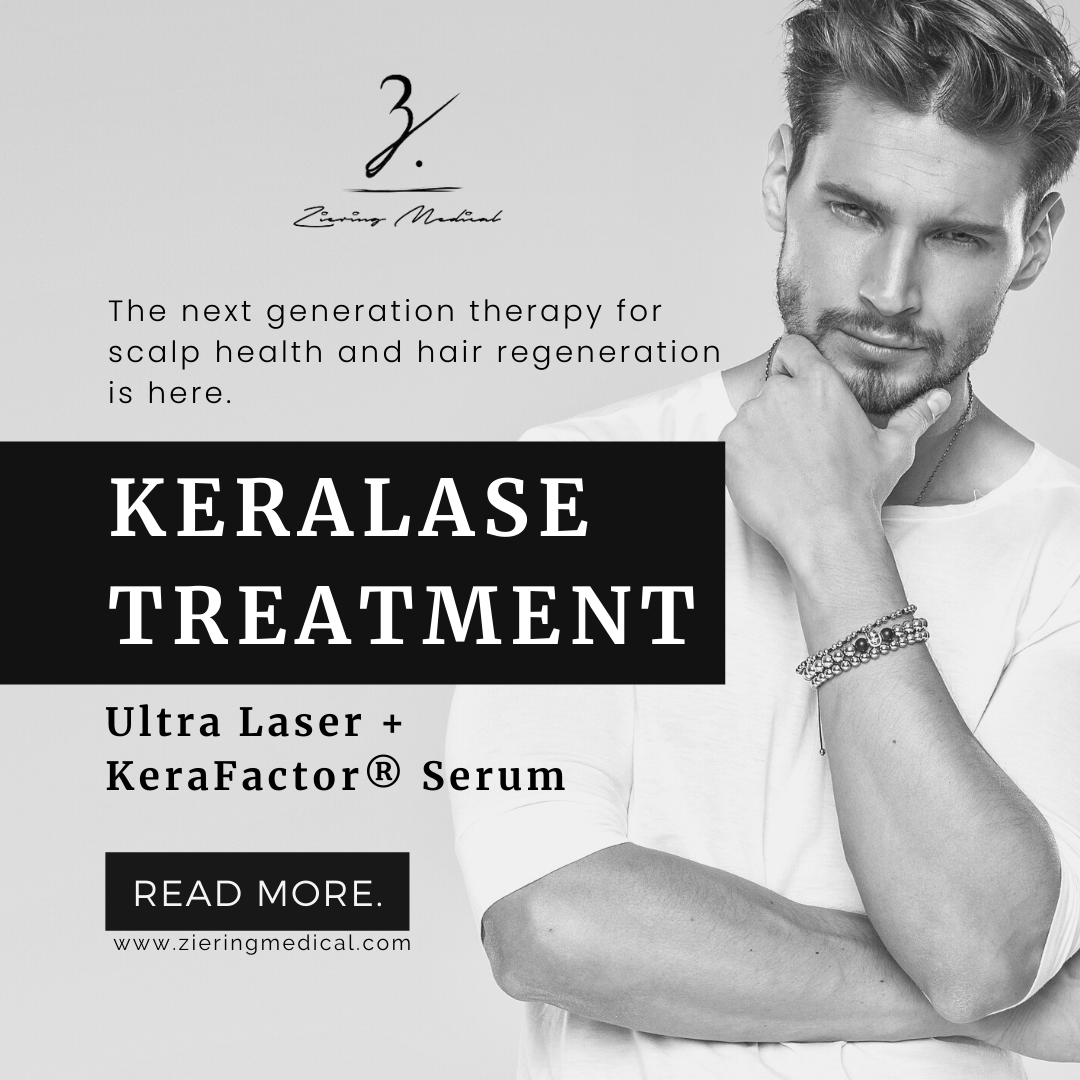 Read more about the article Keralase Combines Medical and Laser Therapy to Treat Hair Loss