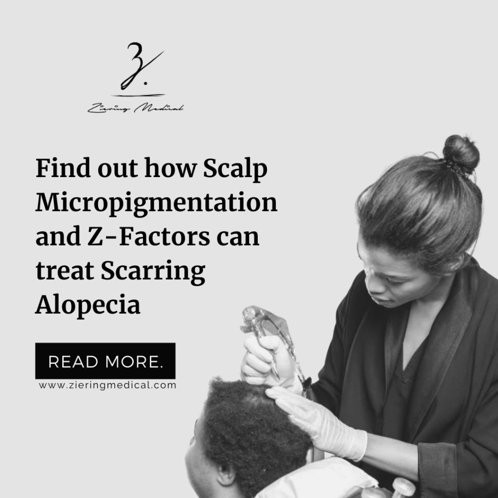 In the case of patients who are not suited for surgery, we have a variety of non-surgical treatments that have been proven to help with scarring alopecia.