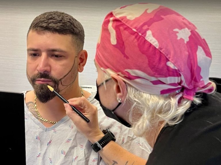 Comprehensive Guide to Facial Hair Transplant Procedure