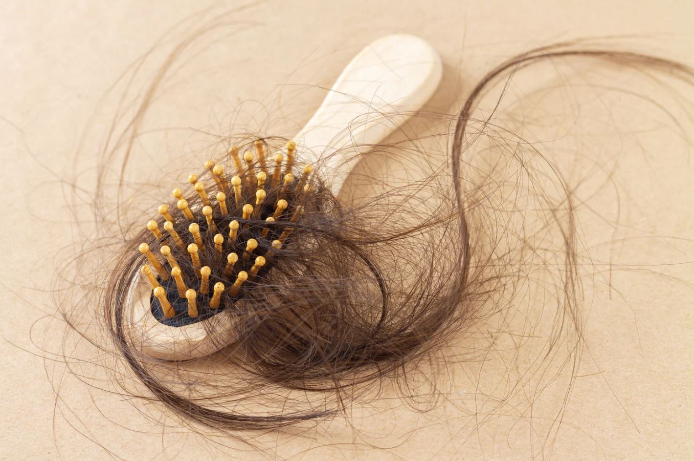 Read more about the article  Which Vitamin Deficiency Causes Hair Loss? 