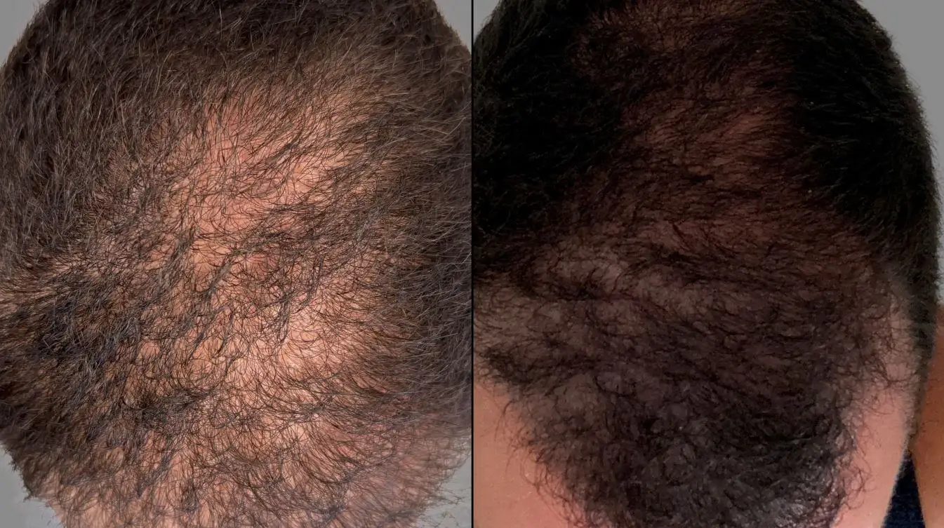 zgro results 2